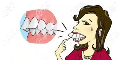 需要做牙齒矯正的齙牙問題 需要做牙齒矯正的齙牙問題