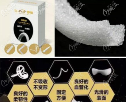 美國舒鉑鼻假體材料的優(yōu)點