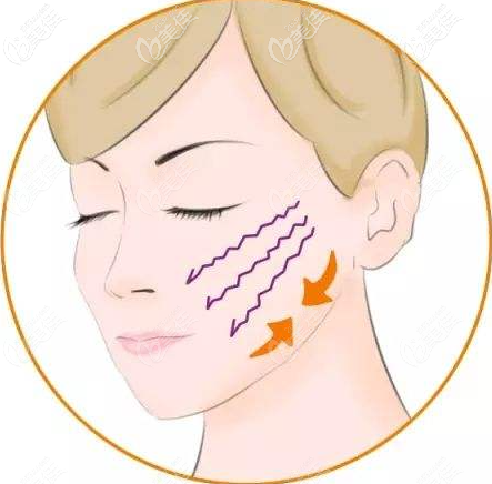 v美減齡v3是怎樣做的 v美減齡v3是怎樣做的