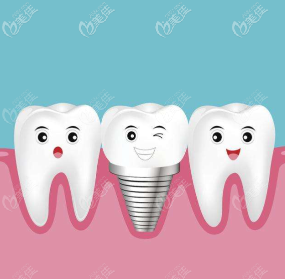 寧波壹加壹種植牙技術(shù)怎么樣？