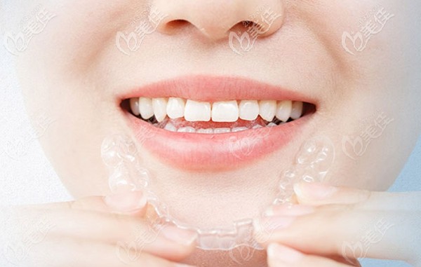 廈門峰煜口腔隱適美牙齒矯正器 廈門峰煜口腔隱適美牙齒矯正器