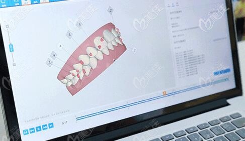 口掃系統(tǒng) 口掃系統(tǒng)