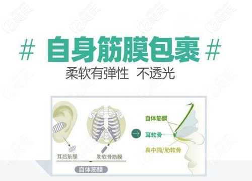 自體筋膜隆鼻原理