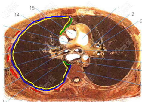 肋軟骨和胸膜圖