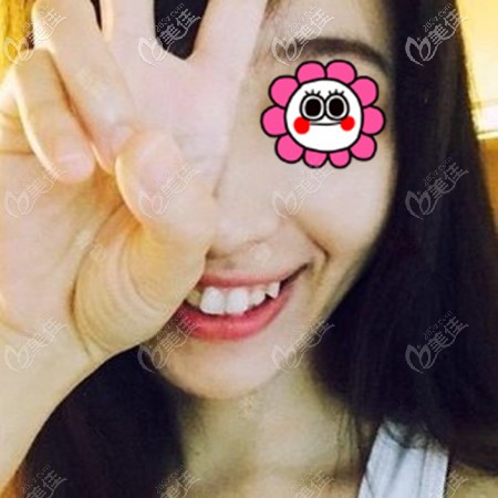 金屬自鎖托槽的品牌 金屬自鎖托槽的品牌