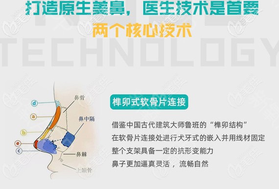 你覺得價值9800元的成都恒博天姿半肋軟骨加硅膠隆鼻怎么樣？