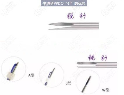 美迪塑埋線針的優(yōu)勢