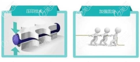 秘特埋植線3D立體壓印技術(shù)優(yōu)勢