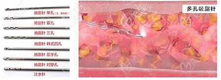 大腿吸脂采用的吸脂針