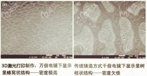 3d烤瓷牙的使用壽命