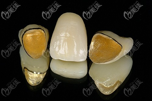 3d烤瓷牙的價(jià)格