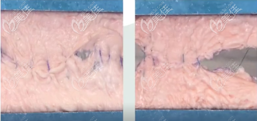 抓持組織能力強(qiáng)