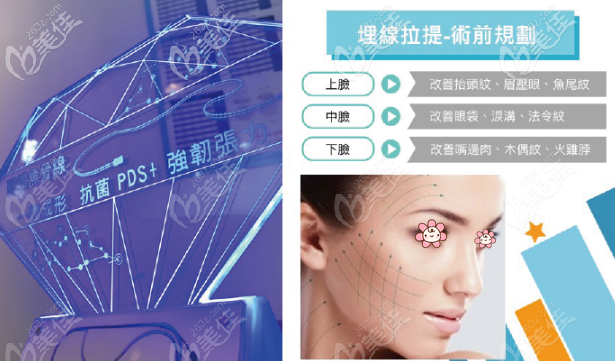 藍(lán)鉆魚骨線的優(yōu)勢(shì)