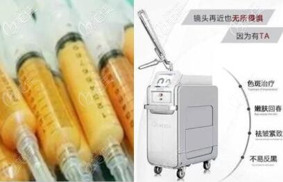 超皮秒和脂肪填充可以一起做嗎