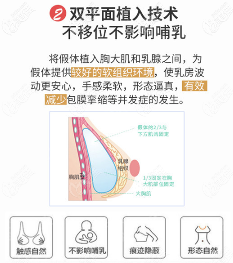 曲梅醫(yī)生做胸部整形的優(yōu)勢(shì)