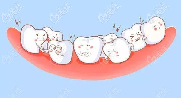 牙齒矯正是上下牙都要帶嗎