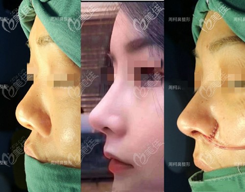 20201225_1608892934230705.jpg 4aadee1bgy1gl0etox3nnj20zk0rtadw.jpg