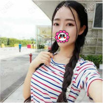 趙翊利(清采)桃花眼眼綜合案例一個(gè)多月效果 趙翊利(清采)桃花眼眼綜合案例一個(gè)多月效果