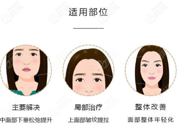 人工韌帶面部提升適應(yīng)部位 人工韌帶面部提升適應(yīng)部位