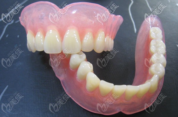 日本松風塑鋼牙示意圖