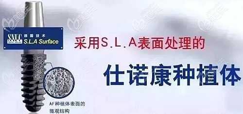 韓國仕諾康種植體的型號