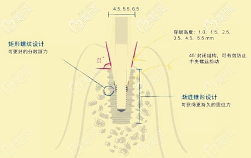 韓國仕諾康種植體好不好