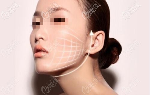 單線的進針方向