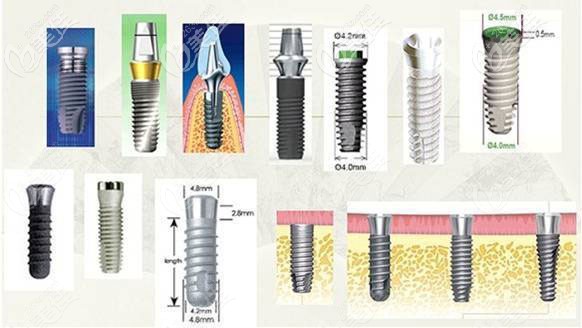 不同品牌的種植系統(tǒng) 不同品牌的種植系統(tǒng)