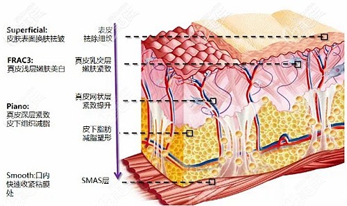 福州名韓Fotona 4D Pro層次