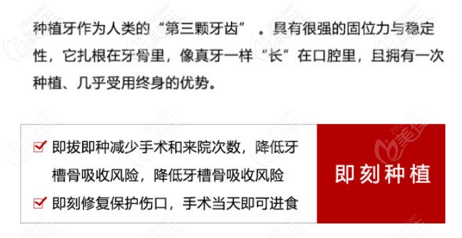 即刻種植技術(shù)