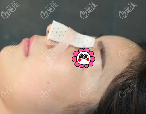 術(shù)后當天 術(shù)后當天