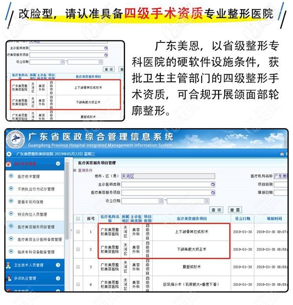 廣州美恩具備四級手術(shù)資質(zhì) 廣州美恩具備四級手術(shù)資質(zhì)