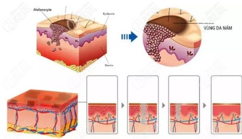 白瓷娃娃的效果 白瓷娃娃的效果