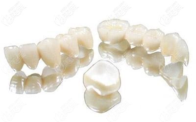 根管治療后戴冠是金屬的還是瓷的好