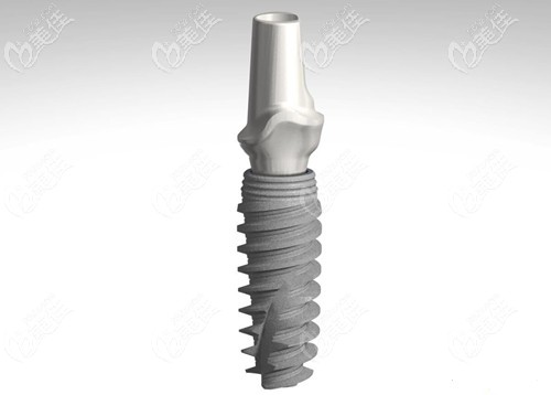 諾貝爾active種植體價格