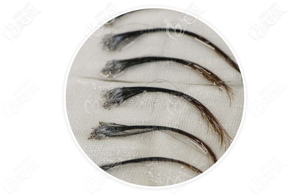 成都首瑞不剃發(fā)長(zhǎng)發(fā)種植 成都首瑞不剃發(fā)長(zhǎng)發(fā)種植