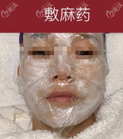 皮秒祛斑敷麻藥中 皮秒祛斑敷麻藥中