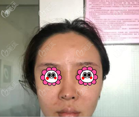 術(shù)后當(dāng)天 術(shù)后當(dāng)天