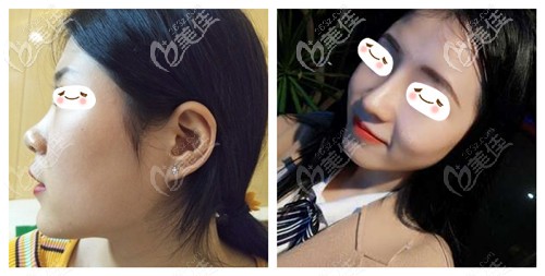 <!--<i data=20240703-sp></i>-->做過的鼻子案例 <!--<i data=20240703-sp></i>-->做過的鼻子案例