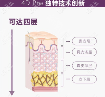 Fotona4Dpro在技術上的優(yōu)勢