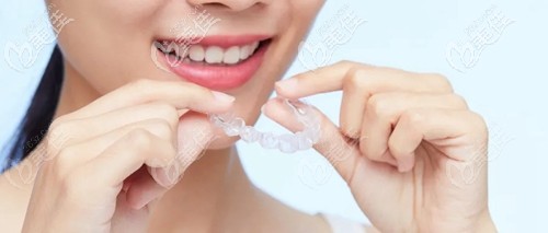 正畸方案確定好帶牙套 正畸方案確定好帶牙套