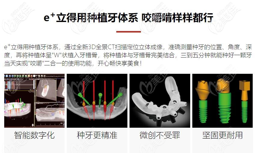 中諾自己研發(fā)的特色技術(shù)——立得用種植牙 中諾自己研發(fā)的特色技術(shù)——立得用種植牙