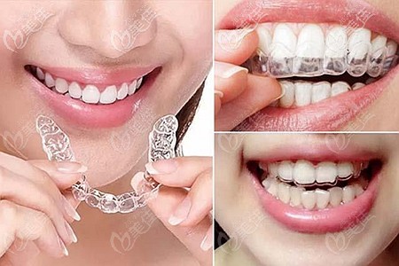 正雅日夜版和時(shí)代天使<span style=