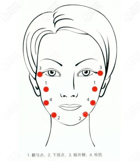 鋸齒線的進針位置