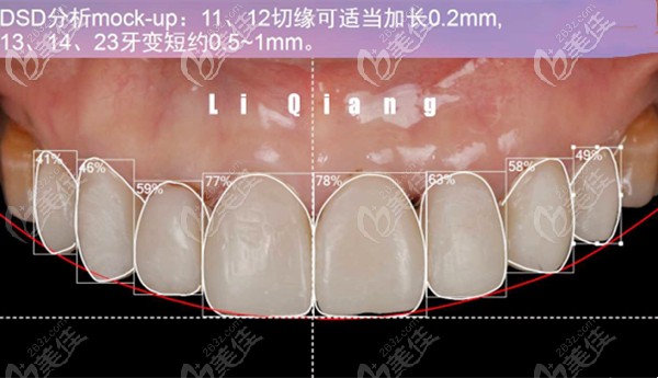 口腔美學(xué)修復(fù)的概念 口腔美學(xué)修復(fù)的概念