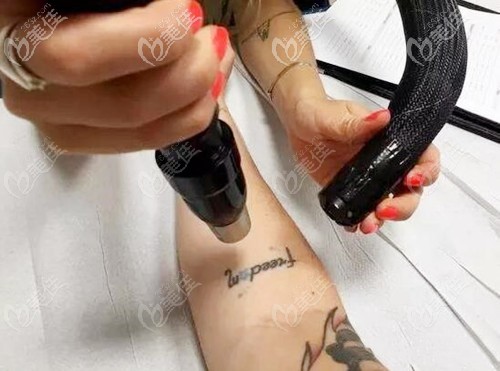皮秒洗紋身的過(guò)程 皮秒洗紋身的過(guò)程
