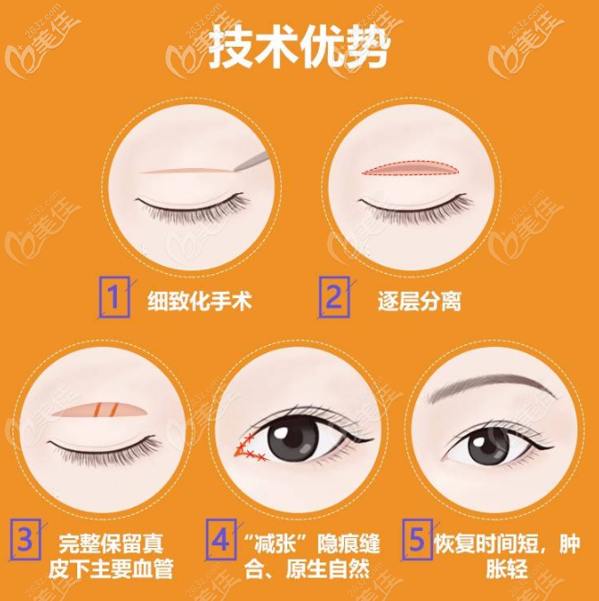 深圳福雅胡俊杰醫(yī)生雙眼皮優(yōu)勢