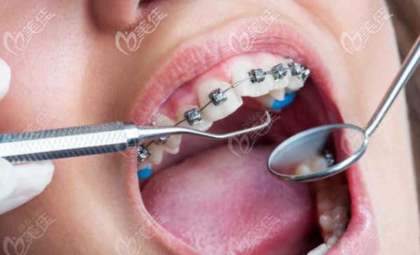 路春宇醫(yī)生擅長牙齒矯正等技術 路春宇醫(yī)生擅長牙齒矯正等技術