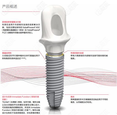 諾貝爾pcc種植牙