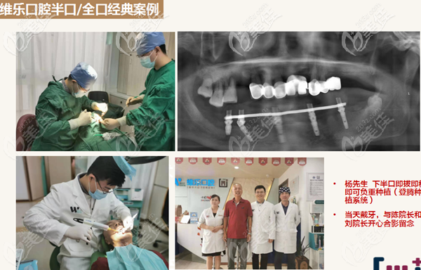 泉州維樂下半口登騰系統(tǒng)即拔即種案例